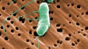 florida39s first flesh eating bacteria death of 2026
