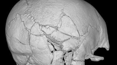 the 14th century warriors skull was broken in 61 places university of bradford photo